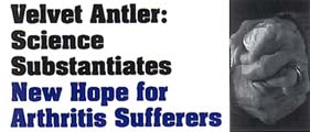 Arthritis Brochure